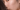Understanding Pigmentation: What You Really Need to Know
