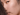 Understanding Pigmentation: What You Really Need to Know