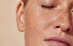 Extreme close-up of a person’s cheek with freckles and smooth skin texture under natural lighting.