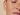 Extreme close-up of a person’s cheek with freckles and smooth skin texture under natural lighting.