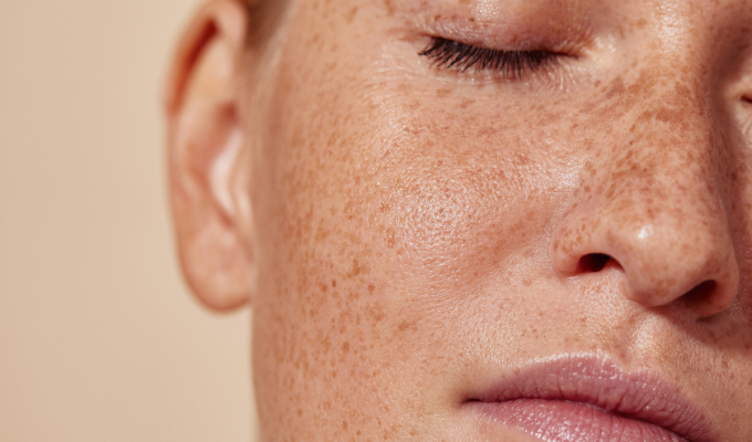 Extreme close-up of a person’s cheek with freckles and smooth skin texture under natural lighting.