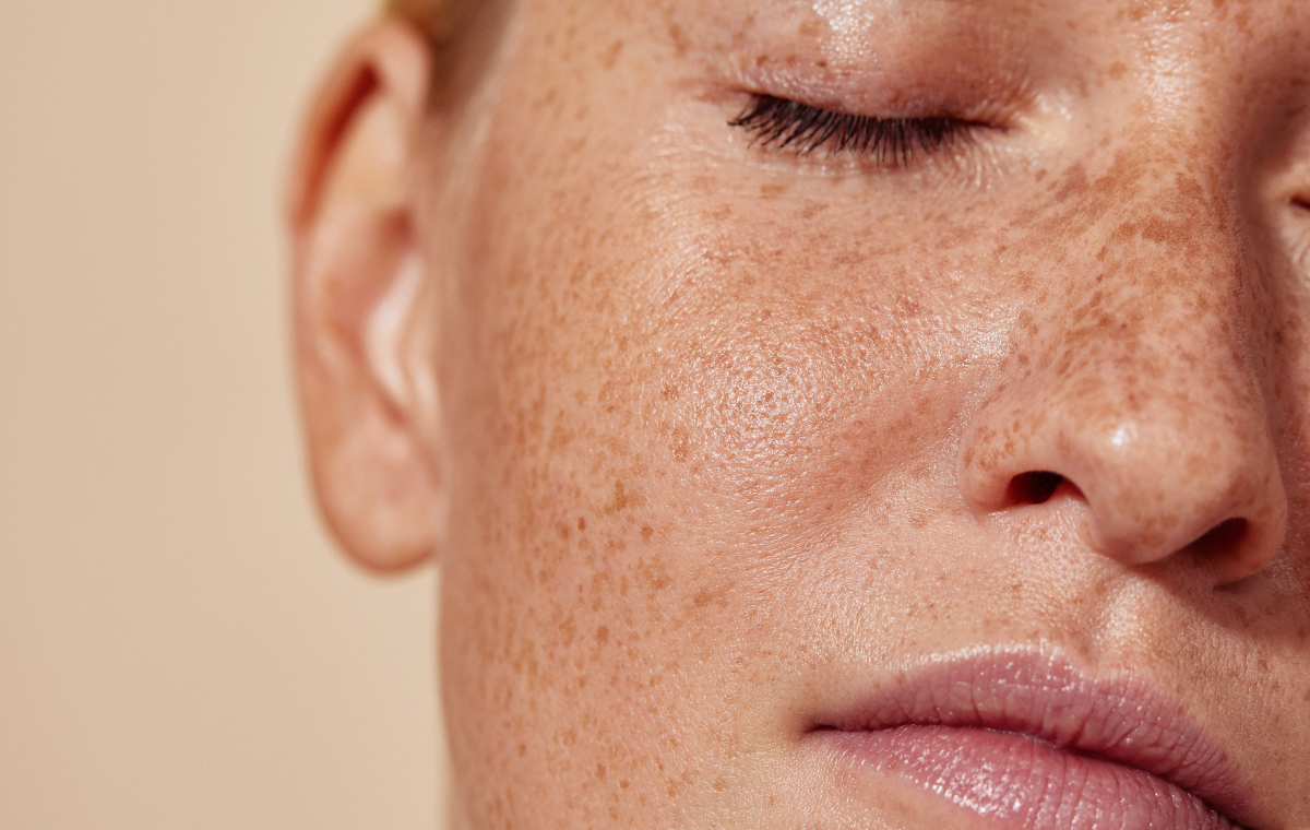 All About Solar Radiation & Your Skin