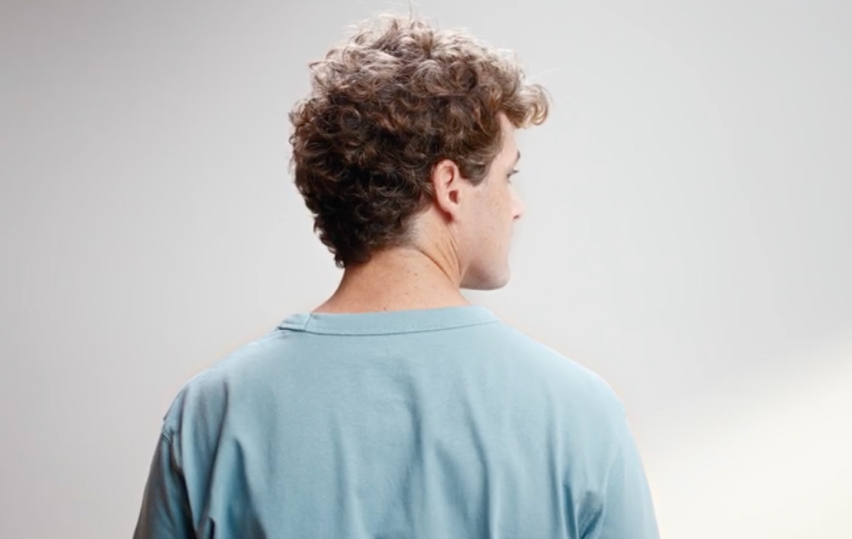 What Causes Hair Loss & Baldness_ 4 Potential Reasons Explained