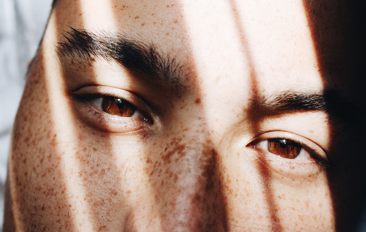 Bags Under Eyes in Men_ How to Fight Back