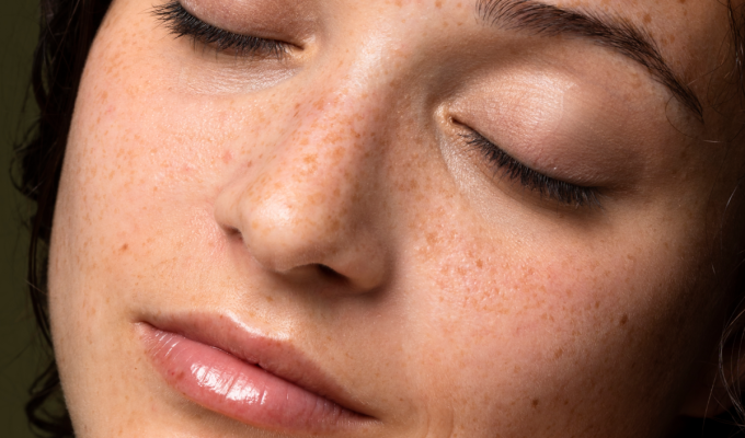 What Is the Skin Barrier? (And Is Yours Healthy?)