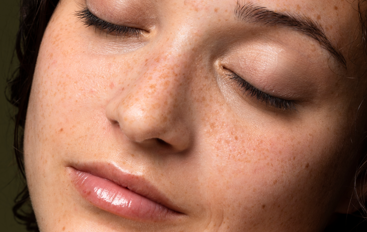 What Is the Skin Barrier? (And Is Yours Healthy?)