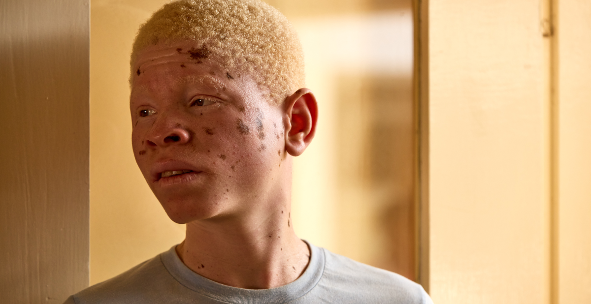 ISDIN partnered with the África Directo Foundation