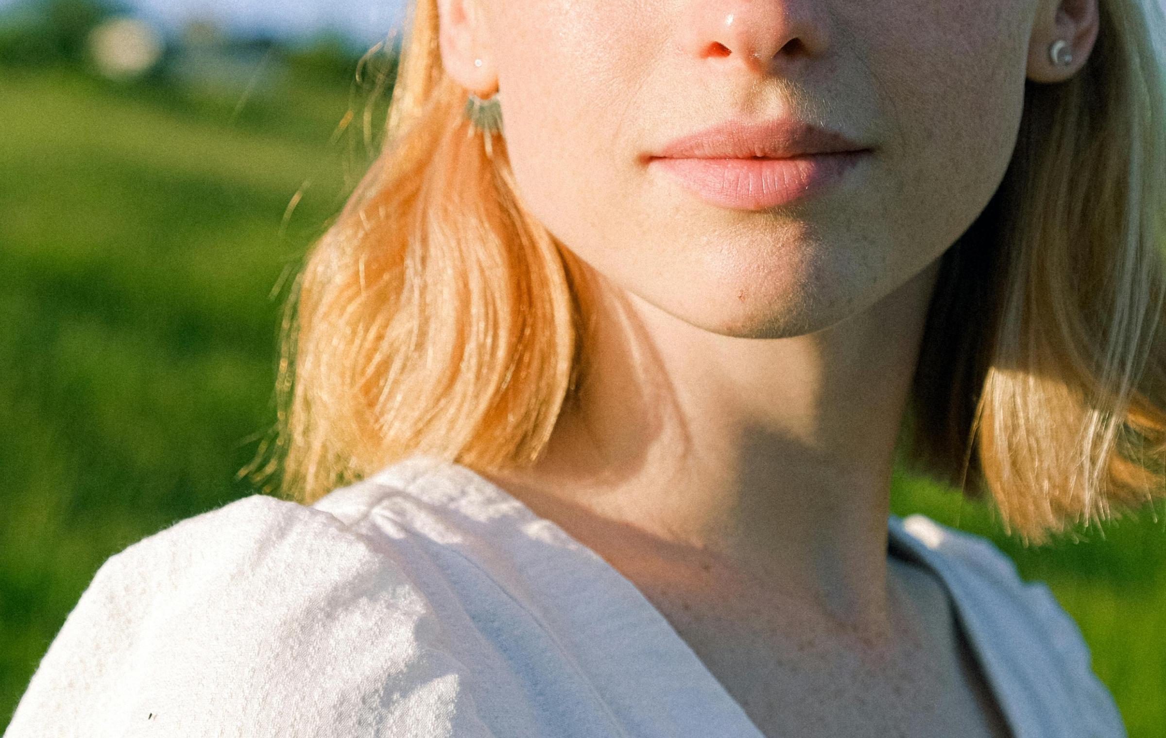 What is a sun allergy