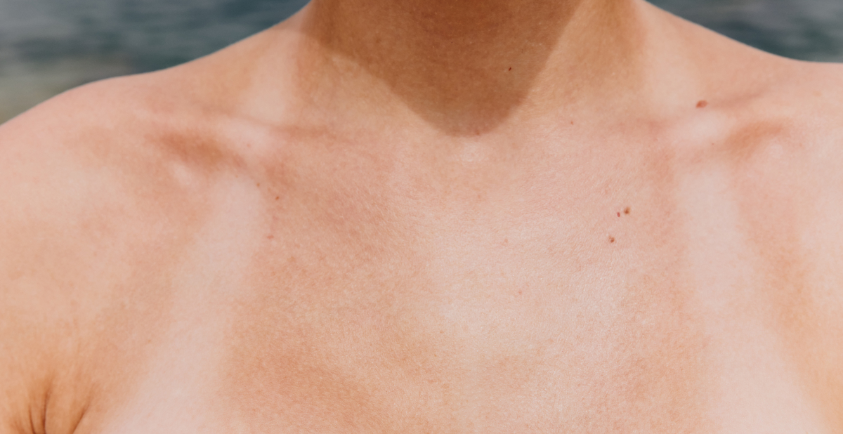 sun tanned skin