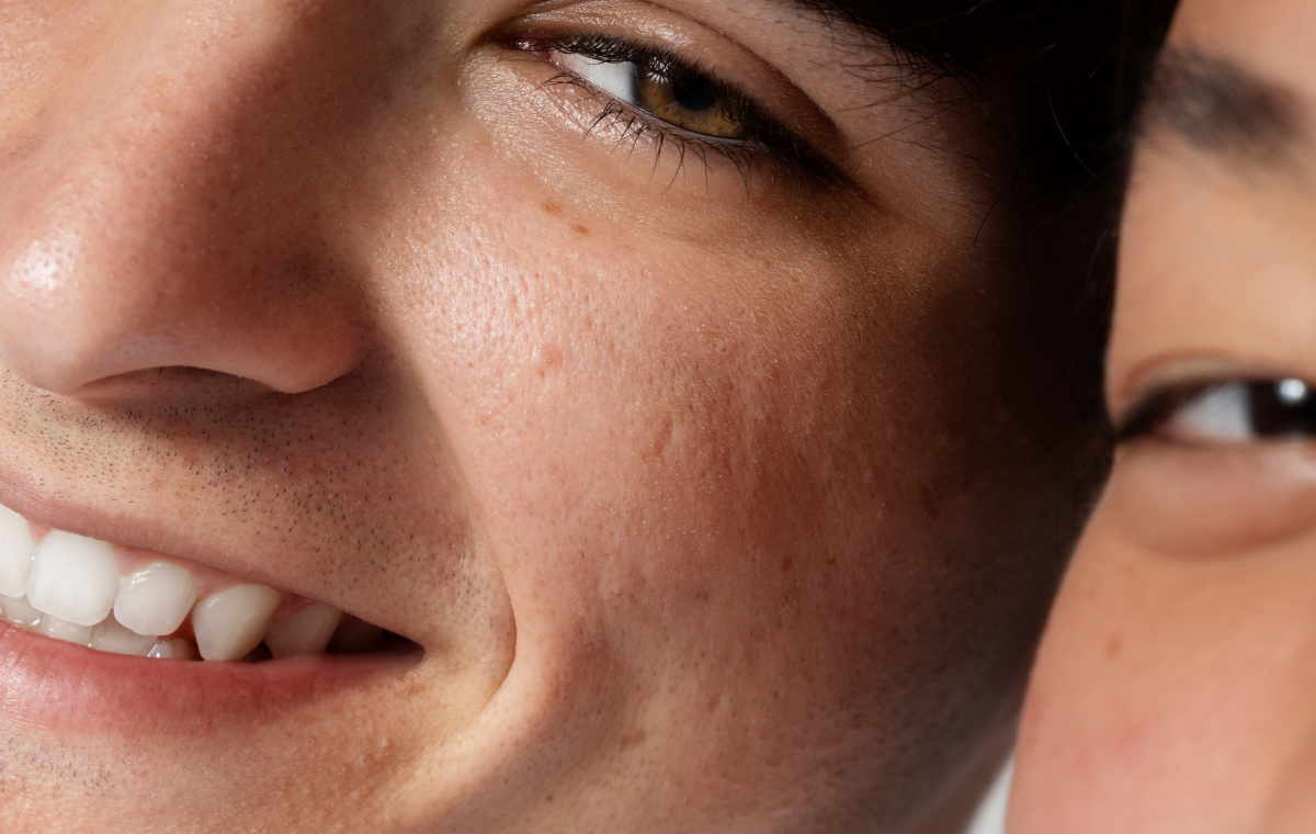 Pores, Up Close: What Are They And Why Are They (Sometimes) So Visible?