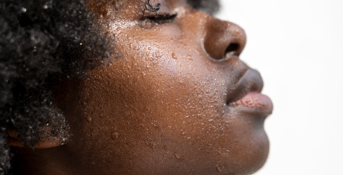 NMFs Explained: What They Do for Your Skin and How to Support Them