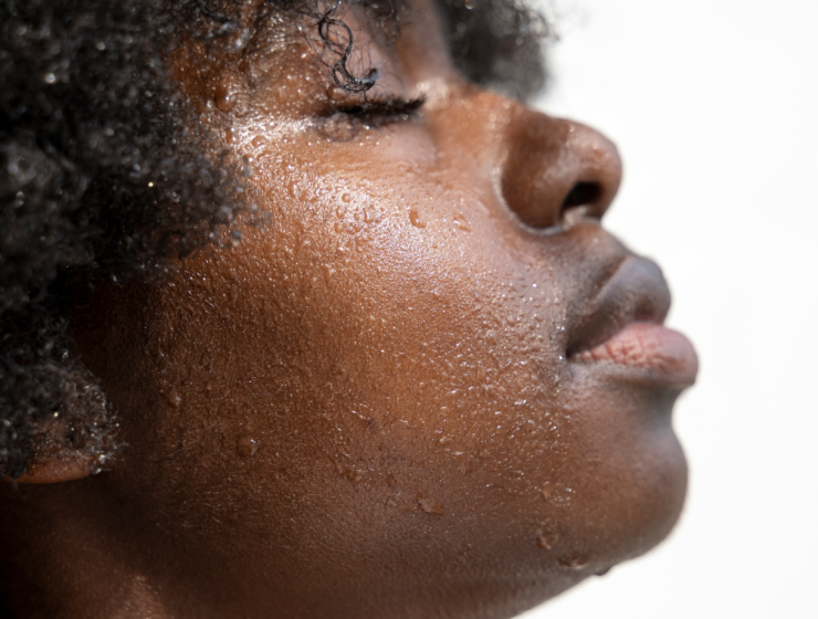 NMFs Explained: What They Do for Your Skin and How to Support Them