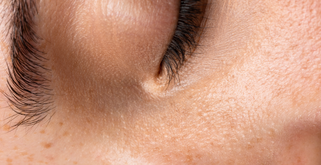 How long does it take for skin to renew itself?